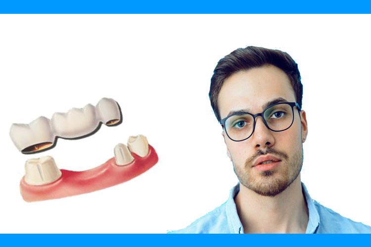 Fiksna i mobilna protetika: zubni mostovi i krunice u keramici, proteze na implantatima, parcijalne i totalne proteze